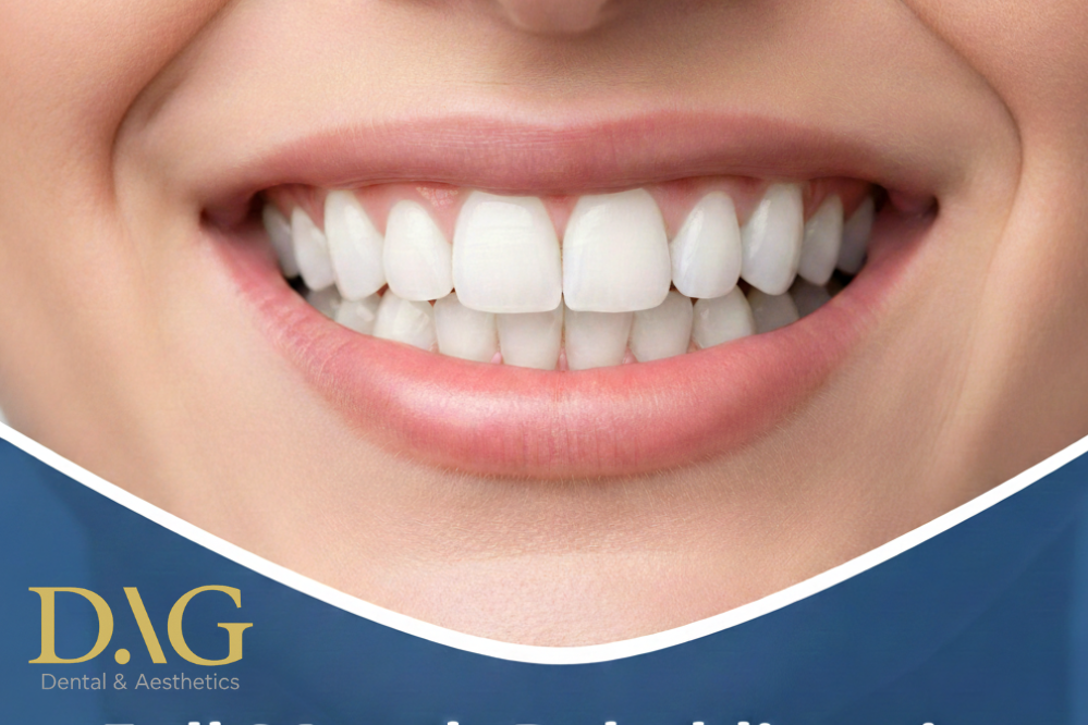 Full Mouth Rehabilitation