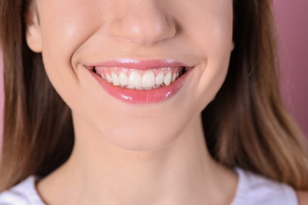 Gummy Smile Treatment for Balanced and Aesthetic Smile Correction