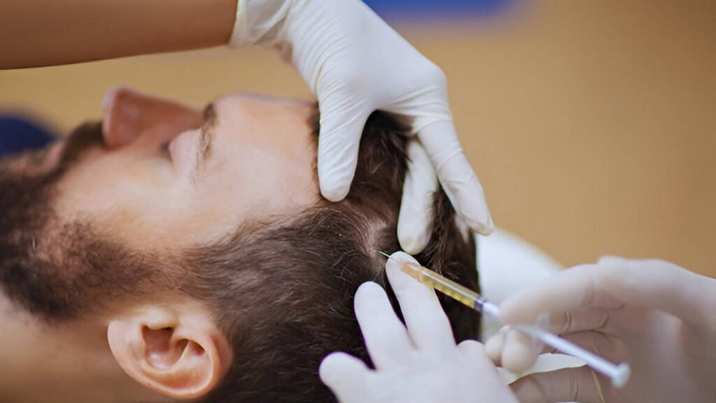 Platelet-rich plasma therapy for hair loss and thinning hair