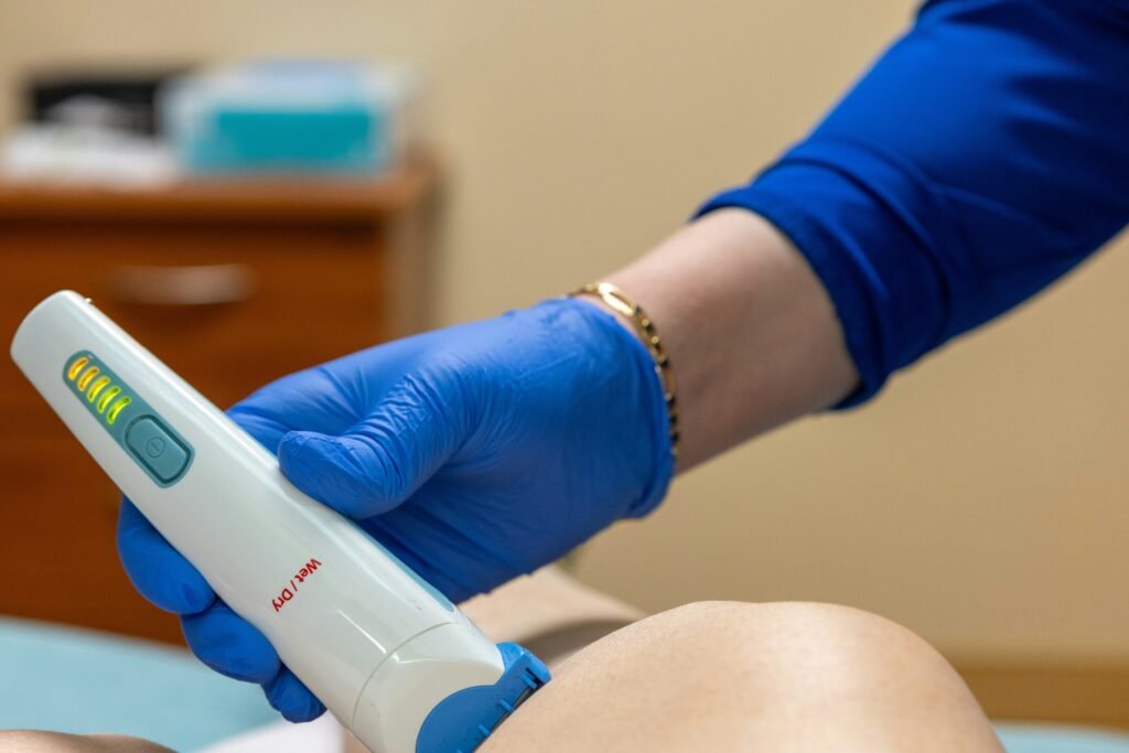 Close-up of laser mole removal process for facial mole removal