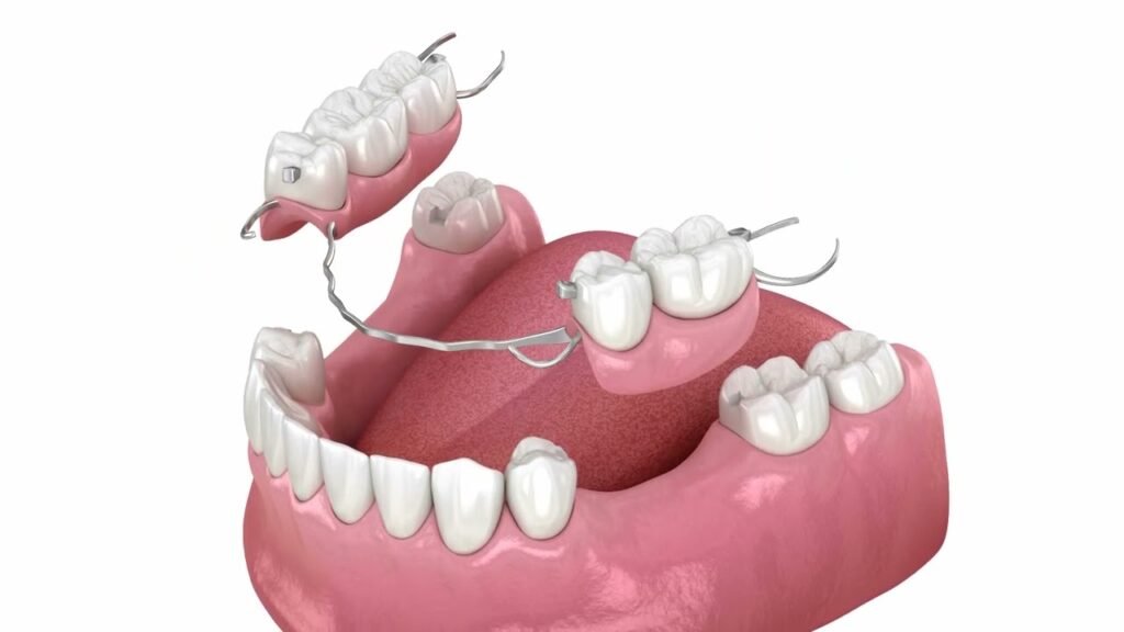 Dental Fillings Treatment for Repairing Cavities and Tooth Damage