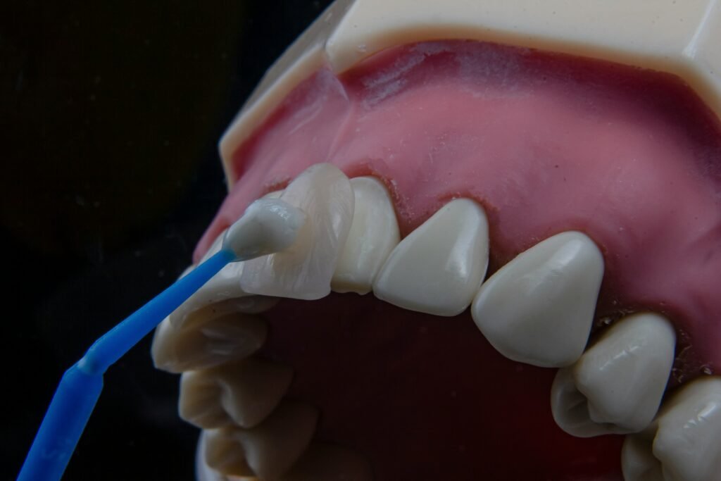 Veneers Treatment at DAG Dental Clinic and Aesthetics for a Natural and Confident Smile Makeover in Lahore