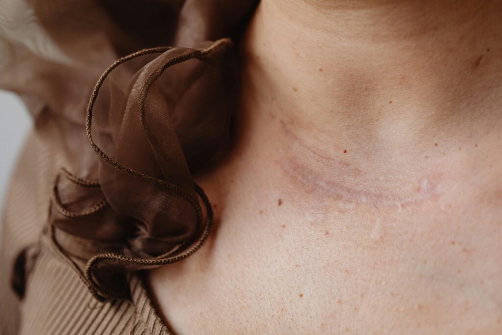 Professional scar removal treatment for acne scars and skin rejuvenation at DAG Dental Clinic and Aesthetics
