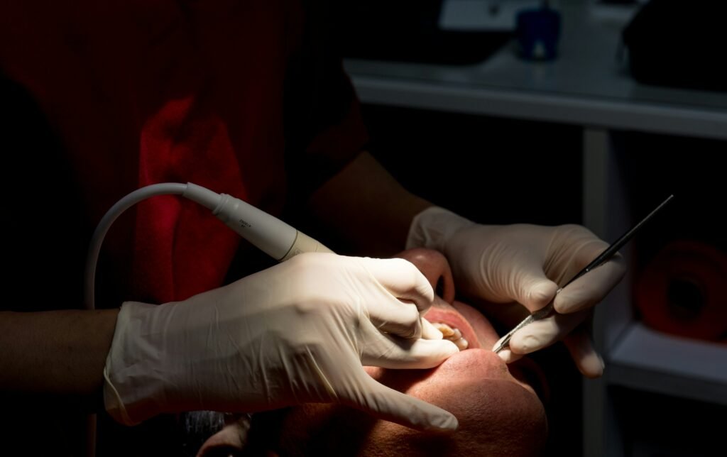 Teeth Fillings
