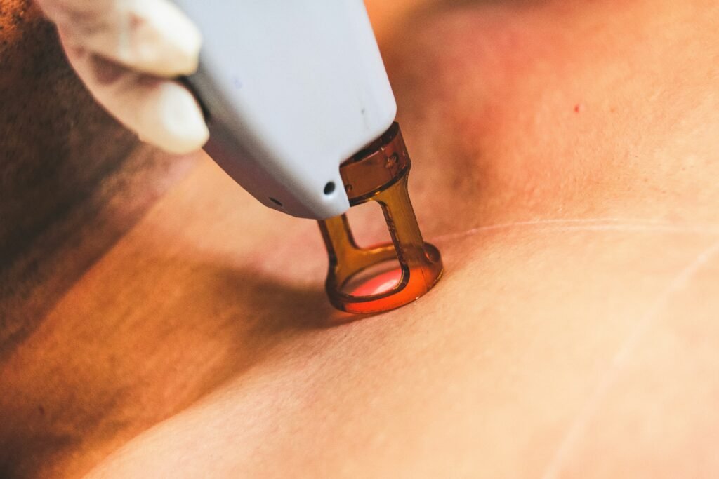 Laser mole removal treatment performed at DAG Dental Clinic and Aesthetics for safe skin care